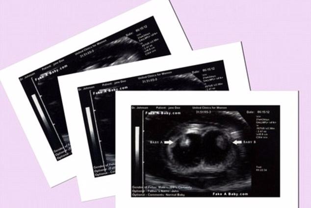 Chửa trâu 10 tháng chưa đẻ, gia đình bàng hoàng khi phát hiện bí mật đen tối của cô con gái tuổi teen-5