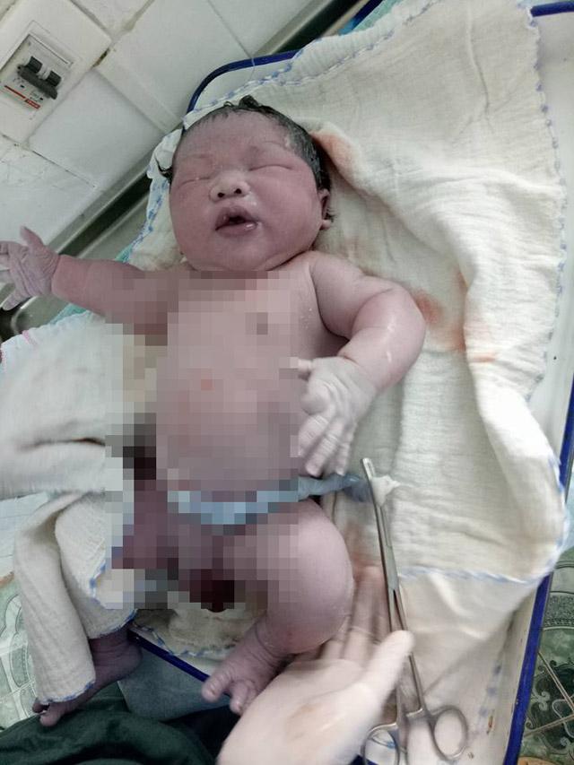 Bé trai chào đời với cân nặng kỷ lục 7,1kg ở Vĩnh Phúc-1