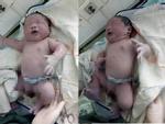 Bé trai chào đời với cân nặng kỷ lục 7,1kg ở Vĩnh Phúc