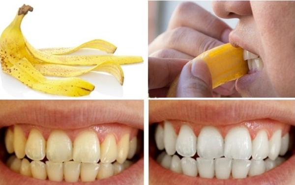 1001 cách làm trắng răng tự nhiên, rẻ tiền chẳng cần đi nha sĩ-5