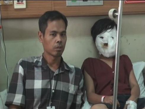 Kinh hoàng: Bà kế bị nghi ngờ ấn mặt cháu gái vào chảo dầu nóng vì không chịu làm việc nhà