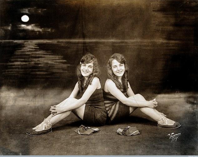 Cặp song sinh liền thân xinh đẹp nhất thế giới, kết hôn với hai ông chồng nhưng đến chết vẫn là trinh nữ-1