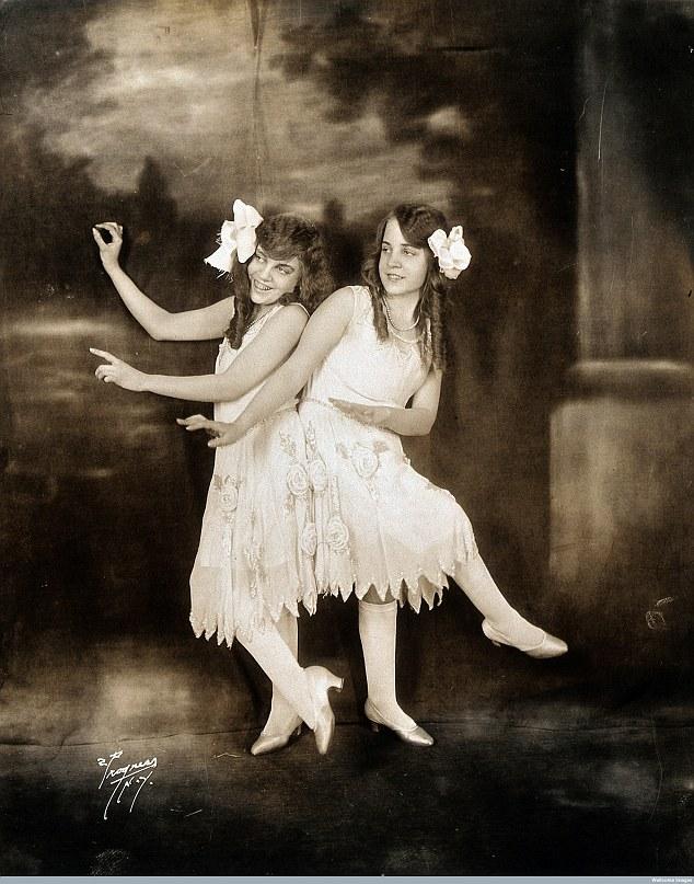 Cặp song sinh liền thân xinh đẹp nhất thế giới, kết hôn với hai ông chồng nhưng đến chết vẫn là trinh nữ-4