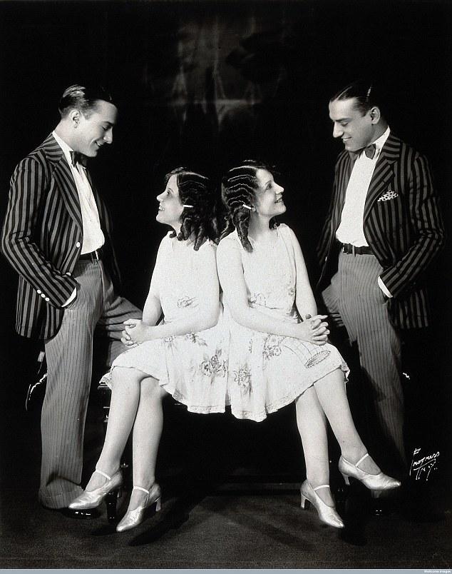 Cặp song sinh liền thân xinh đẹp nhất thế giới, kết hôn với hai ông chồng nhưng đến chết vẫn là trinh nữ-8