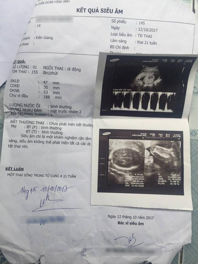 Bé gái 14 tuổi bị hàng xóm xâm hại đến mang thai, phải nghỉ học chờ sinh con-4