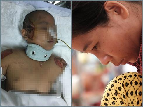 Tai nạn đau lòng: Tránh chó chạy rông, gia đình 4 người thương vong dưới bánh xe tải