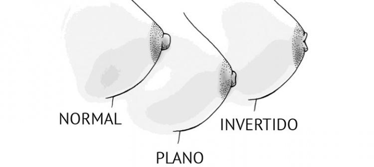Con gái nên tự kiểm tra núi đôi thường xuyên để xem có điều gì bất thường hay không-4