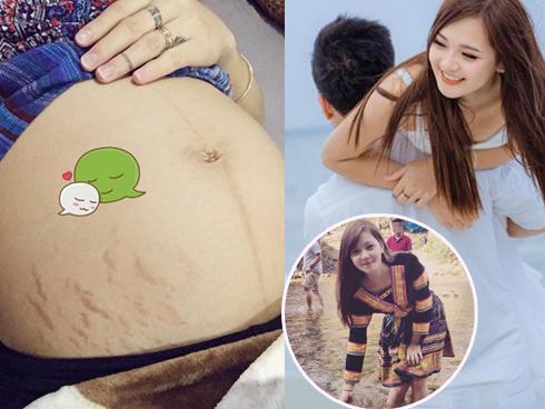 'Hot girl dân tộc' Thu Hương hạnh phúc dù không còn eo thon, da xuất hiện nhiều vết rạn nứt