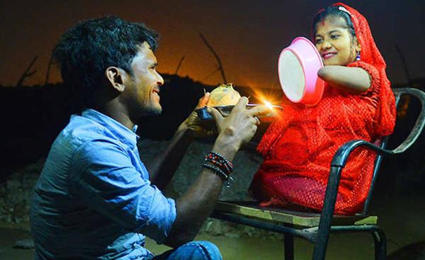 Tình yêu đáng ngưỡng mộ của chú rể bại liệt và cô dâu không có tứ chi-3