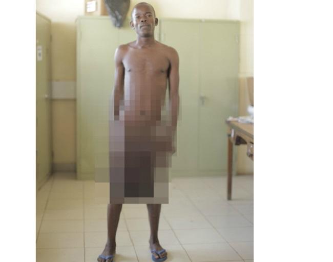 Niềm hạnh phúc của chàng trai trẻ có của quý dài hơn 1m sau khi được phẫu thuật thu nhỏ-3