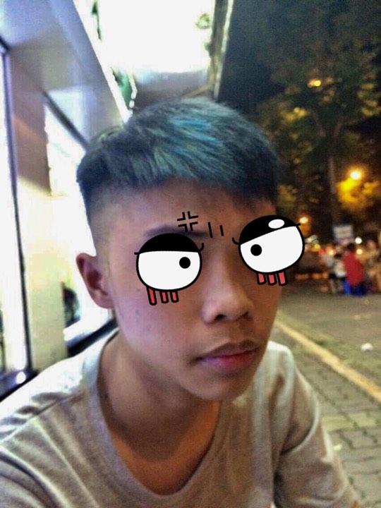 Chàng trai quyết định đập môi thâm đi xây lại và cái kết không đẹp cho lắm-2