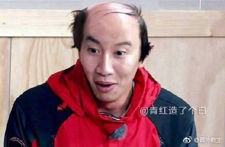 Photoshop đã chứng minh: Mỹ nam đẹp đến mấy mà bị hói đầu thì cũng không thể yêu thương nổi-1