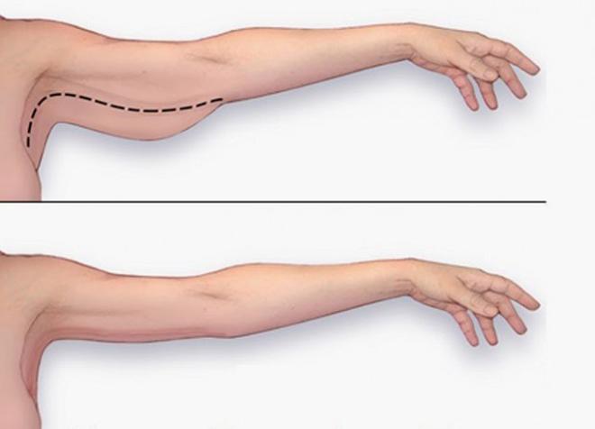 Con gái không lo lên cơ ở bắp tay nữa khi tập các bài tập giảm mỡ này-2