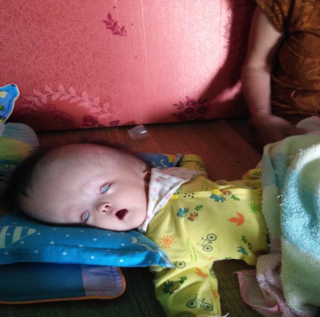 Cuộc sống đau đớn của bé gái 8 tháng tuổi mồ côi cha, cái đầu như muốn nổ tung vì căn bệnh não úng thủy-1