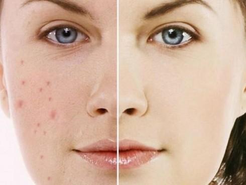 Làm đẹp da bằng nước khoáng có ga được không?-2