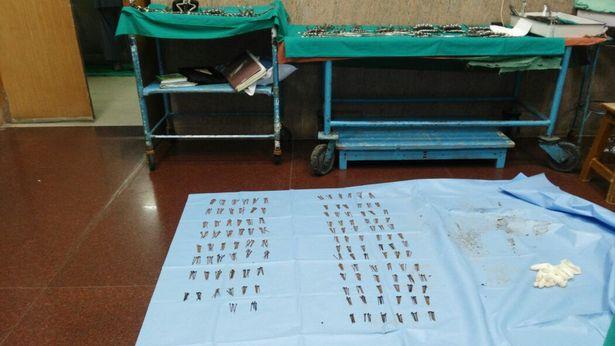 Kinh hoàng: Người đàn ông nuốt 600 cái đinh-3