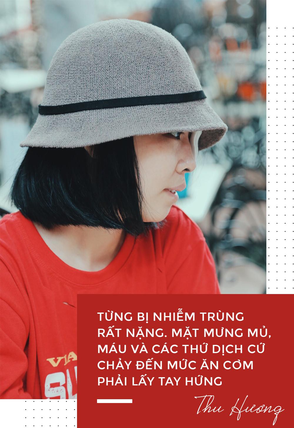 Nữ sinh bị tạt axit ở Sài Gòn: Tình yêu chợt đến khi đời tăm tối nhất!-3