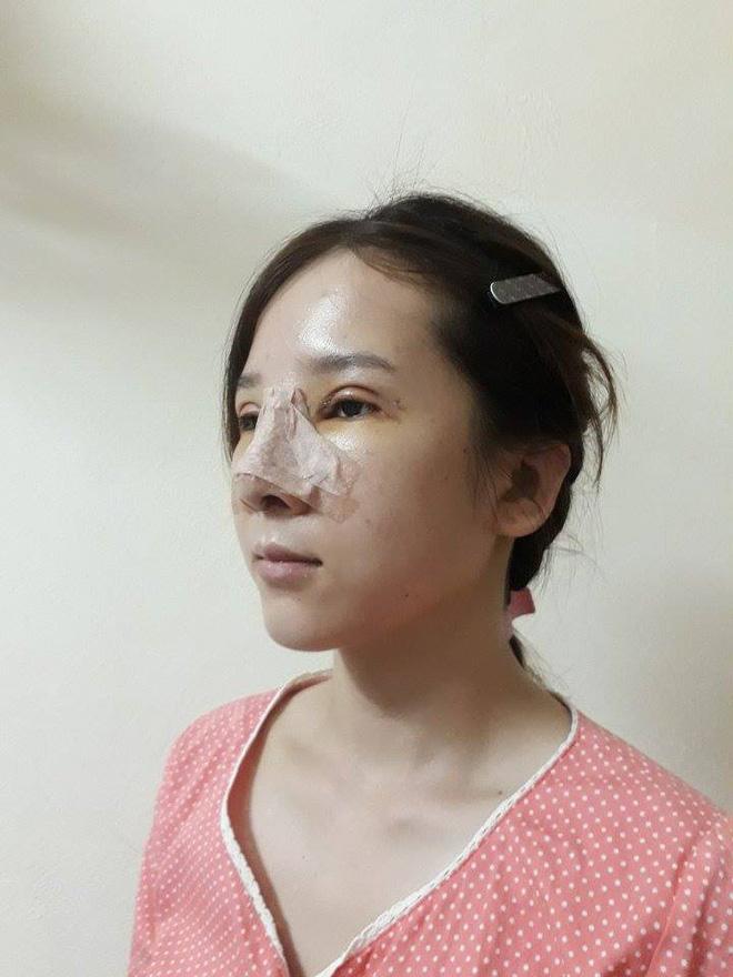 Bị người yêu bỏ, nhà tuyển dụng chê vì mắt lươn, cô gái xứ Nghệ lột xác ấn tượng-5