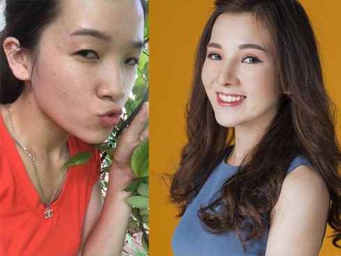 Cô gái 'mắt lươn' bị người yêu đá, nhà tuyển dụng chê trải lòng sau thẩm mỹ