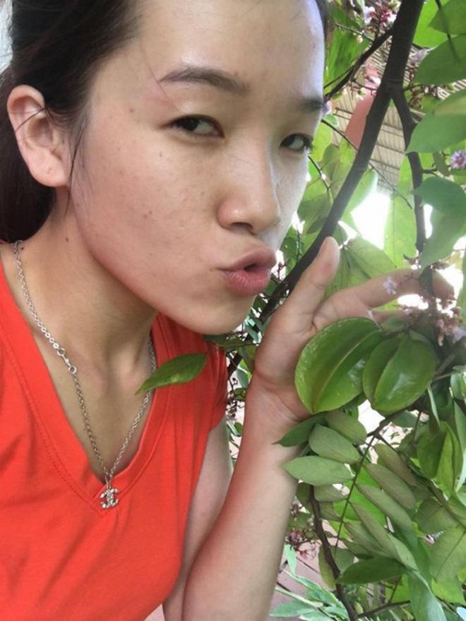 Cô gái mắt lươn bị người yêu đá, nhà tuyển dụng chê trải lòng sau thẩm mỹ-2