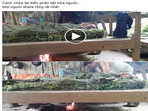 Chuyên gia lên tiếng về clip chữa tai biến mạch máu não bằng cách… hun khói cây lạc tiên