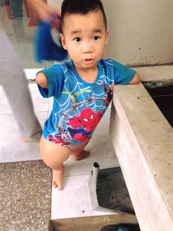 Cảm phục cô bé Sọ Dừa xinh xắn, cụt hai chân vẫn tung tăng đến lớp-3