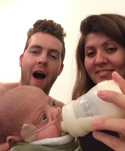 Cuộc chiến giành sự sống của em bé sinh non nặng hơn 4 lạng-3