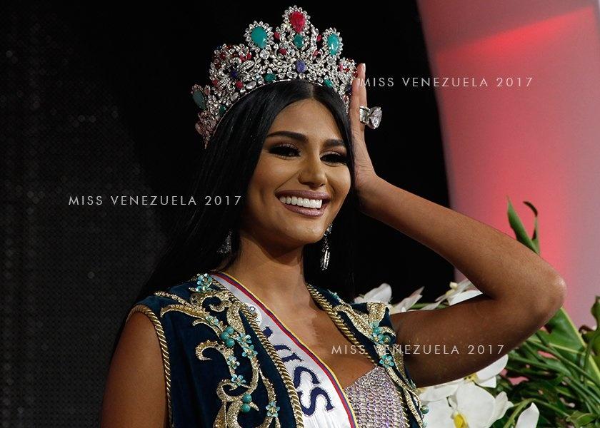 Mỹ nhân sở hữu số đo vàng 90 - 60 - 90 lên ngôi Hoa hậu Venezuela 2017-3