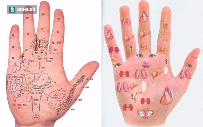 Một điểm trên bàn tay bị đỏ: Dấu hiệu cảnh báo bệnh gan không thể xem nhẹ-2