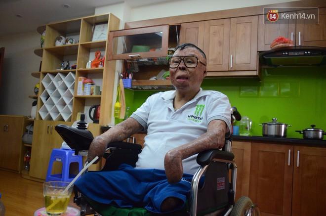 Chiến sĩ duy nhất sống sót sau vụ rơi trực thăng Hòa Lạc nghẹn ngào với đôi tay giả: Tôi vui sướng, hạnh phúc đến quên cả ăn uống-1