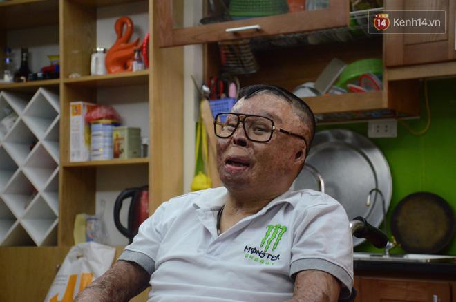 Chiến sĩ duy nhất sống sót sau vụ rơi trực thăng Hòa Lạc nghẹn ngào với đôi tay giả: Tôi vui sướng, hạnh phúc đến quên cả ăn uống-3