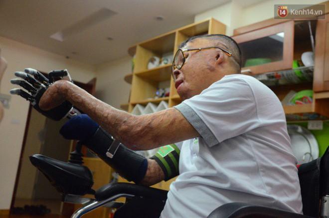 Chiến sĩ duy nhất sống sót sau vụ rơi trực thăng Hòa Lạc nghẹn ngào với đôi tay giả: Tôi vui sướng, hạnh phúc đến quên cả ăn uống-4