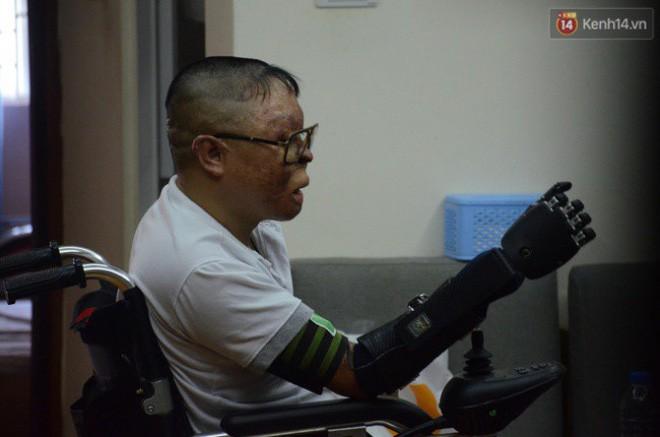 Chiến sĩ duy nhất sống sót sau vụ rơi trực thăng Hòa Lạc nghẹn ngào với đôi tay giả: Tôi vui sướng, hạnh phúc đến quên cả ăn uống-6