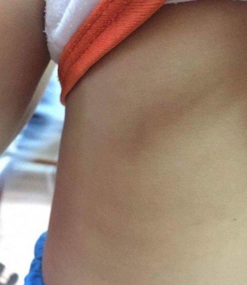 Hà Nội: Người thân kể lại sự việc mẹ kế là giáo viên mầm non đánh con chồng dã man-2