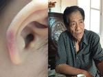 Hà Nội: Người thân kể lại sự việc mẹ kế là giáo viên mầm non đánh con chồng dã man