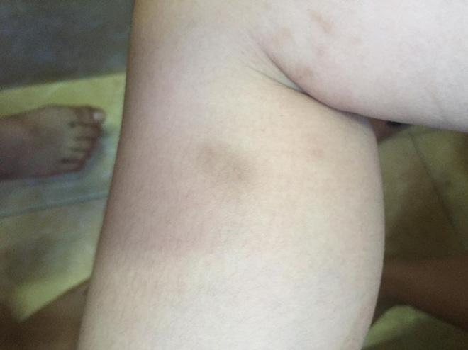 Vụ mẹ kế bạo hành con của chồng: Quay cảnh đánh con tôi đau đớn lắm nhưng cần phải có bằng chứng-3