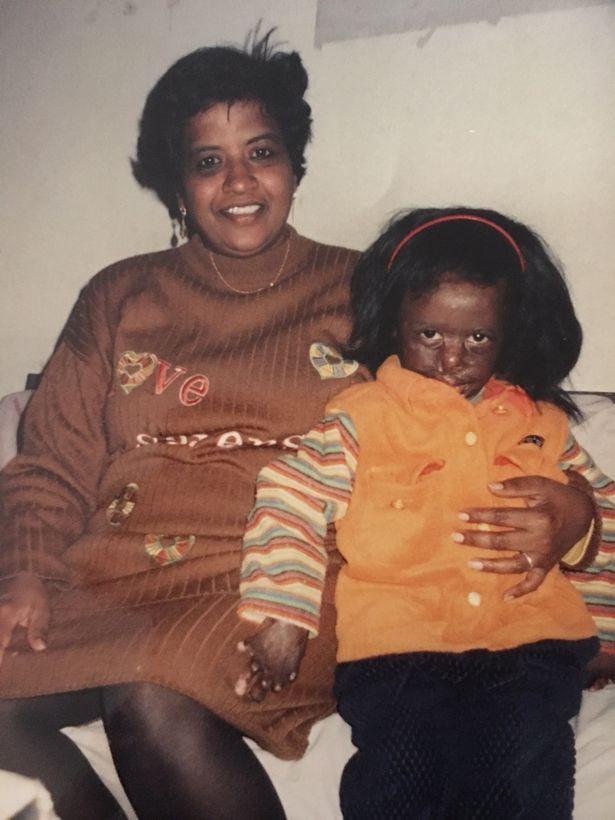 Người phụ nữ có gương mặt quỷ đã luôn muốn chết đi cho xong đến khi gặp được người đàn ông đặc biệt-3