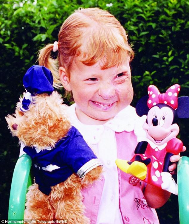 Sinh ra với gương mặt biến dạng và bị người đời xa lánh, phép màu đã khiến cuộc đời cô gái thay đổi sau 25 năm-2