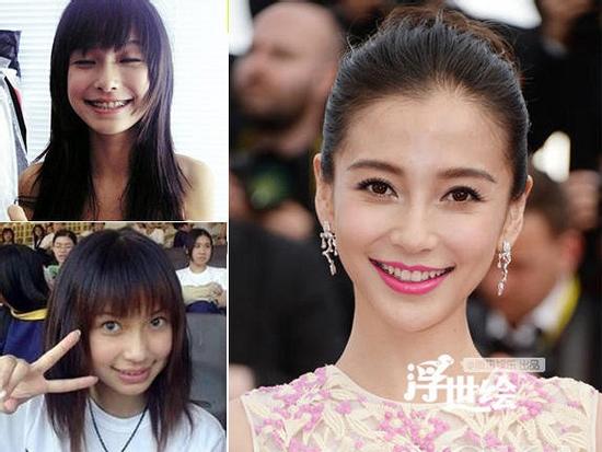 Dàn sao Hoa ngữ đẹp xuất sắc nhờ dũng cảm chỉnh lại 'bộ nhá'