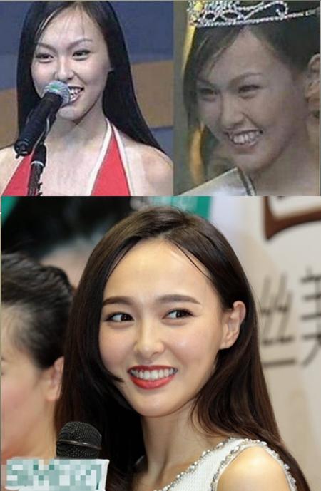 Dàn sao Hoa ngữ đẹp xuất sắc nhờ dũng cảm chỉnh lại bộ nhá-5