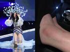 Lộ ảnh cổ chân sưng to, tấy đỏ của Ming Xi sau cú ngã 'trời giáng' tại Victoria's Secret Fashion Show