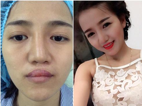 Anh chồng tâm lý nhất năm: Cổ vũ vợ bằng cách giảm béo, thưởng tiền-3