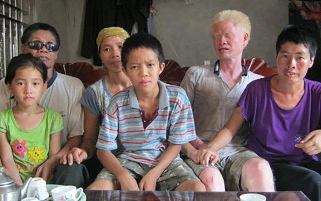 Câu chuyện về tình chị, duyên em cảm động của người thương binh mù lòa-2