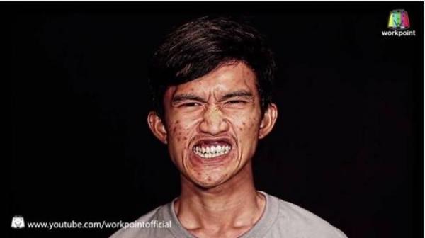 Mất tích 3 tháng, chàng trai có khuôn mặt lưỡi liềm trở về khiến mẹ không nhận ra-1