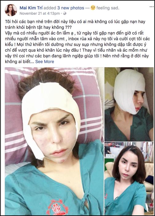 Phát hoảng với gương mặt biến dạng khủng khiếp sau thẩm mỹ của hot girl chuyển giới Linda-1