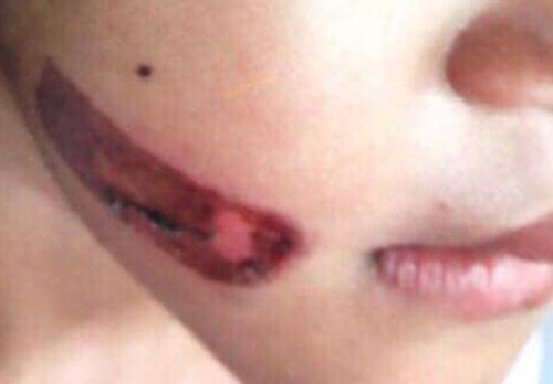 Tình tiết bất ngờ vụ bé gái nghi bị cha và mẹ kế bạo hành-1