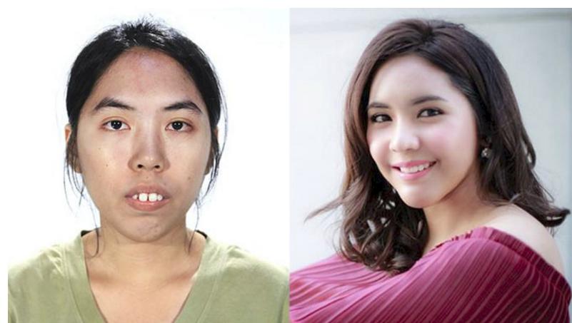 Liên tục bị từ chối khi xin việc, cô gái có khuôn mặt xấu xí biến đổi bất ngờ sau thẩm mỹ-1