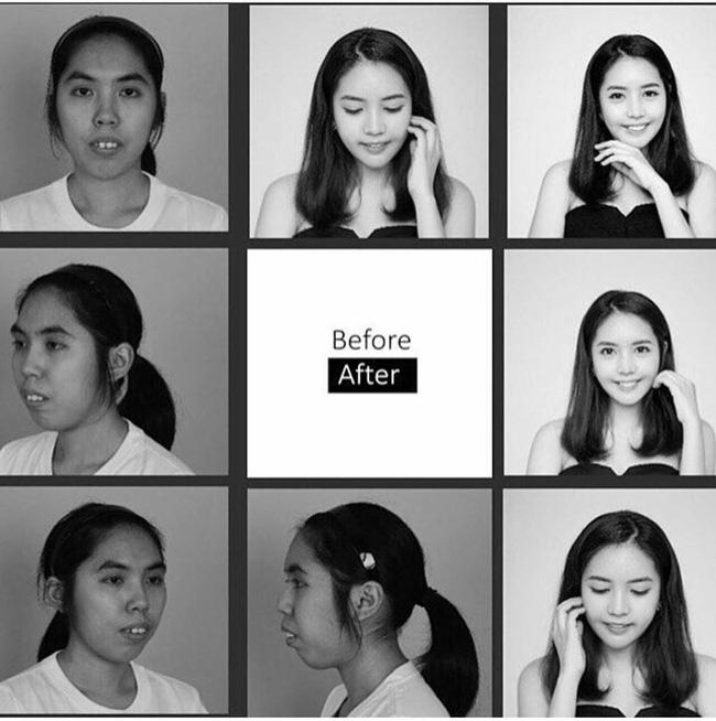 Liên tục bị từ chối khi xin việc, cô gái có khuôn mặt xấu xí biến đổi bất ngờ sau thẩm mỹ-3