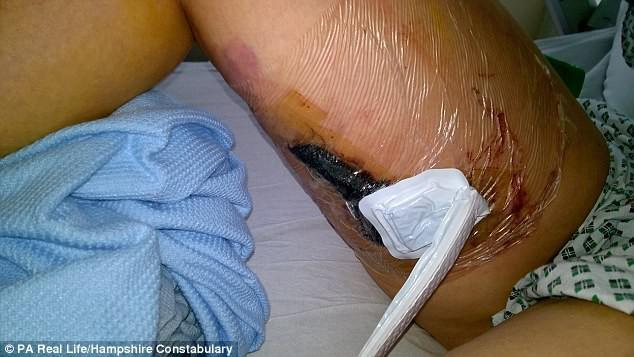 Người phụ nữ tuyệt vọng thoát khỏi người tình mất nhân tính và mang theo vết sẹo đau đớn cả đời-5