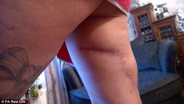 Người phụ nữ tuyệt vọng thoát khỏi người tình mất nhân tính và mang theo vết sẹo đau đớn cả đời-6